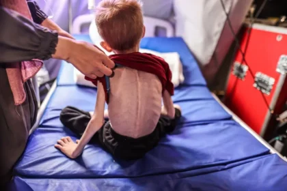 Gaza Malnutrition Crisis: At Least 66 Children Dead as Israel Intensifies Siege