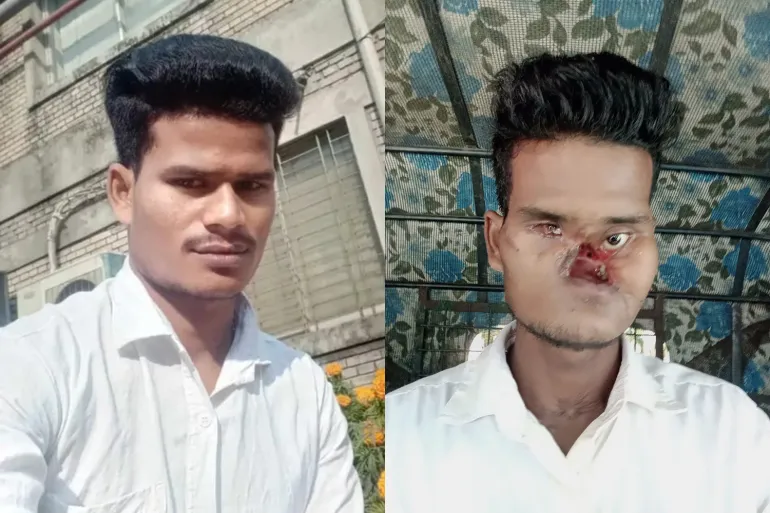 Barman lost almost his entire face after he was shot by the police