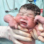 Miracle Baby Born Holding Contraceptive Coil That Failed: Doctor Shares 3 Stunning Photos Breaking the Internet